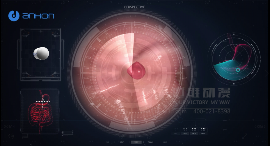 醫(yī)學(xué)醫(yī)療三維動(dòng)畫 醫(yī)學(xué)醫(yī)療三維動(dòng)畫