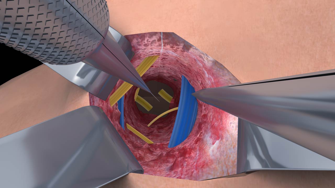 醫(yī)療醫(yī)學(xué)三維動(dòng)畫(huà).jpg 醫(yī)療醫(yī)學(xué)三維動(dòng)畫(huà).jpg