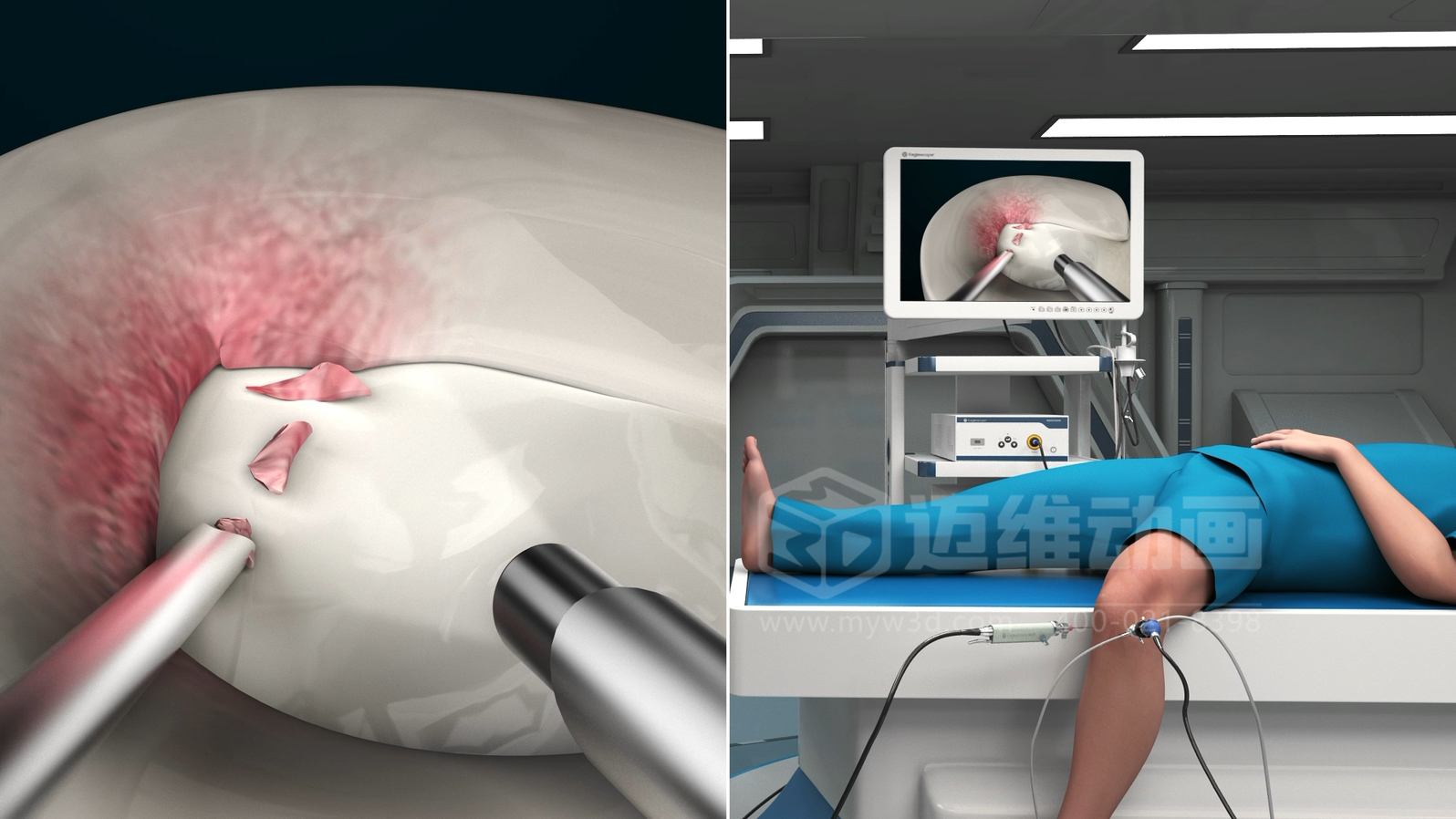 三維動(dòng)畫制作在展現(xiàn)醫(yī)療器械方面能給企業(yè)帶來(lái)諸多優(yōu)勢(shì)，這5點(diǎn)不容忽視！(圖3)