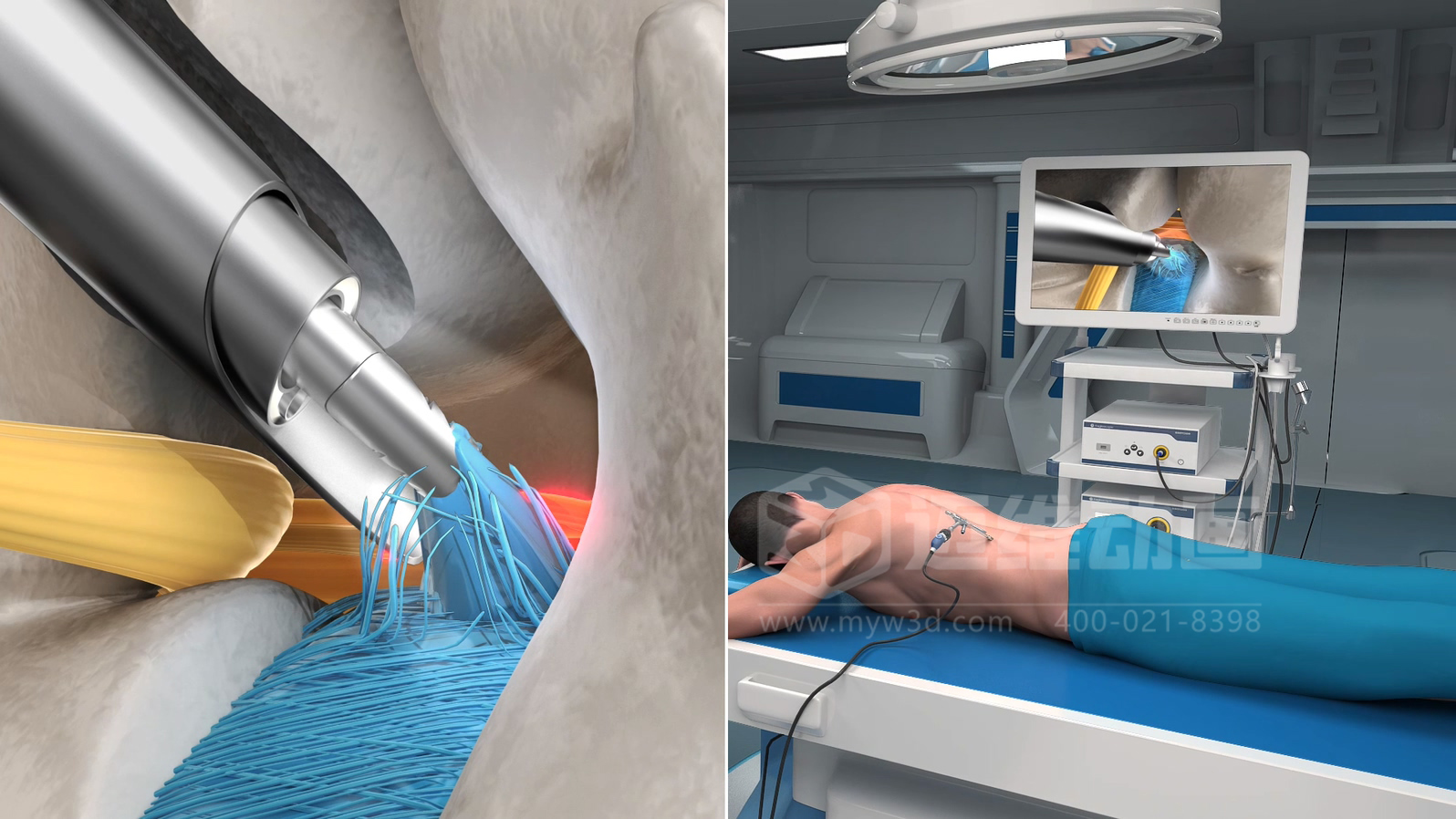 企業(yè)制作工程施工|自動(dòng)化生產(chǎn)線|產(chǎn)品演示|醫(yī)學(xué)行業(yè)三維動(dòng)畫(huà)要準(zhǔn)備哪些資料，以便有效地提供給三維動(dòng)畫(huà)制作公司呢？(圖7)