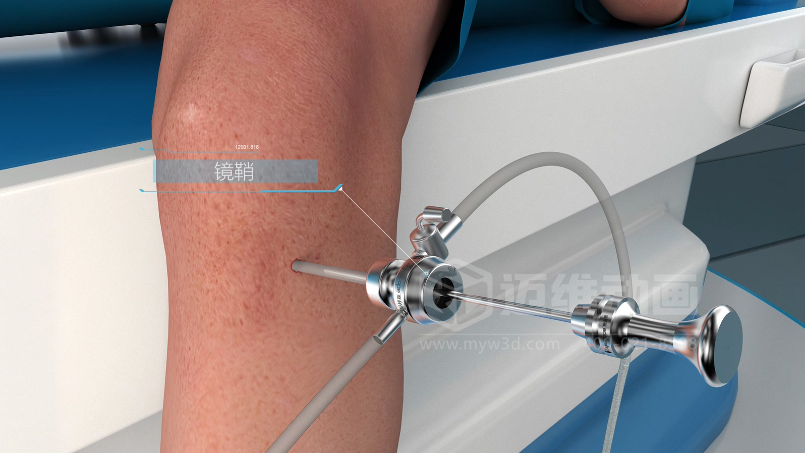 醫(yī)學(xué)手術(shù)三維動(dòng)畫制作公司哪家好？解碼上海邁維動(dòng)漫的醫(yī)學(xué)醫(yī)療3D可視化創(chuàng)新之路(圖2)