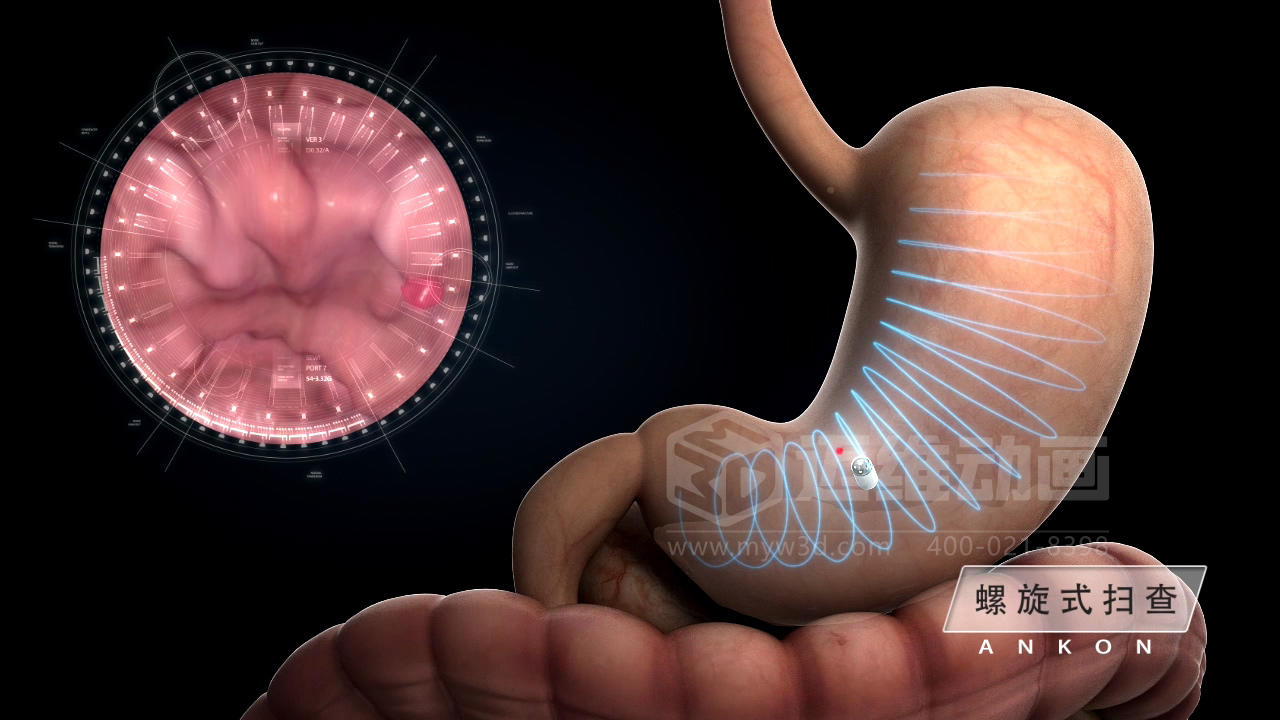 從實驗室到手術(shù)室：邁維動漫用三維動畫，讓精密科技“看得見，懂得到”訂單轉(zhuǎn)化率提高 50%(圖3)