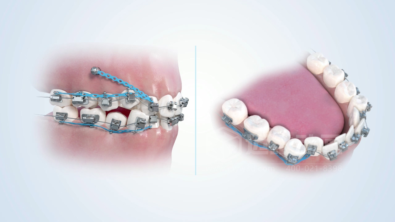 從實驗室到手術(shù)室：邁維動漫用三維動畫，讓精密科技“看得見，懂得到”訂單轉(zhuǎn)化率提高 50%(圖10)