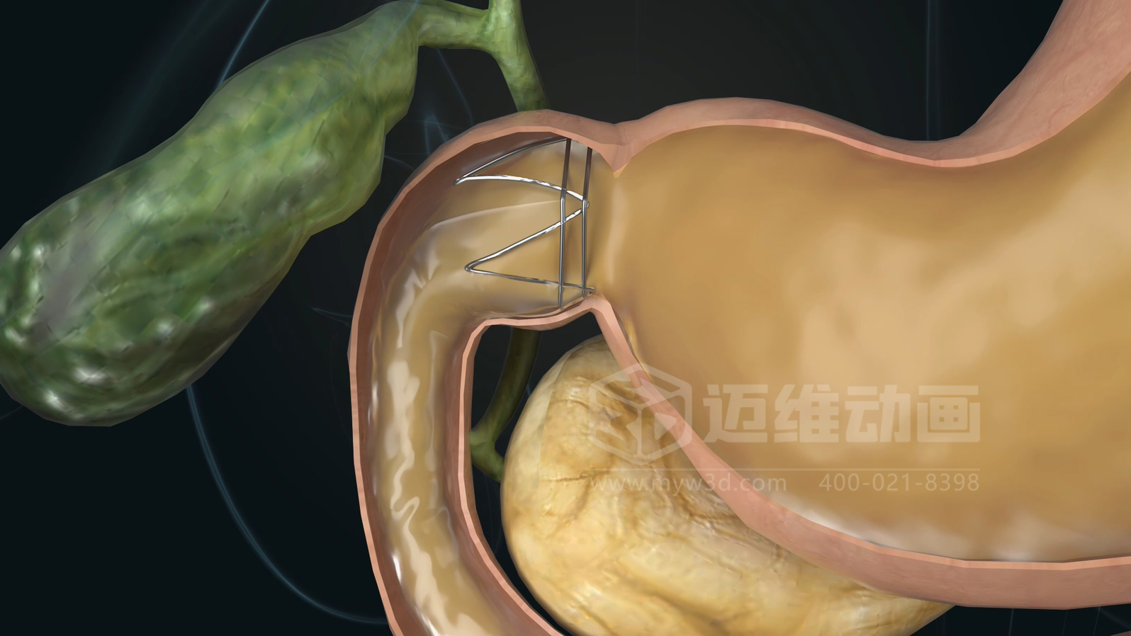 從實驗室到手術(shù)室：邁維動漫用三維動畫，讓精密科技“看得見，懂得到”訂單轉(zhuǎn)化率提高 50%(圖11)