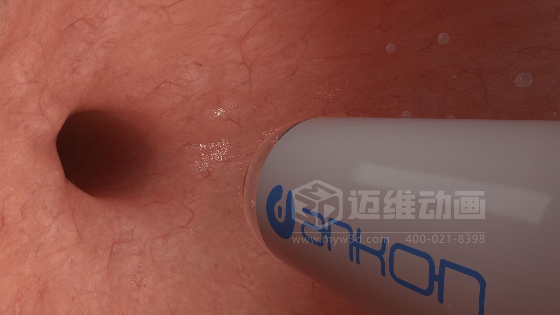 醫(yī)學(xué)檢測(cè)設(shè)備如何突破消化道檢查壁壘？三維動(dòng)畫還原核心技術(shù)與臨床價(jià)值(圖4)