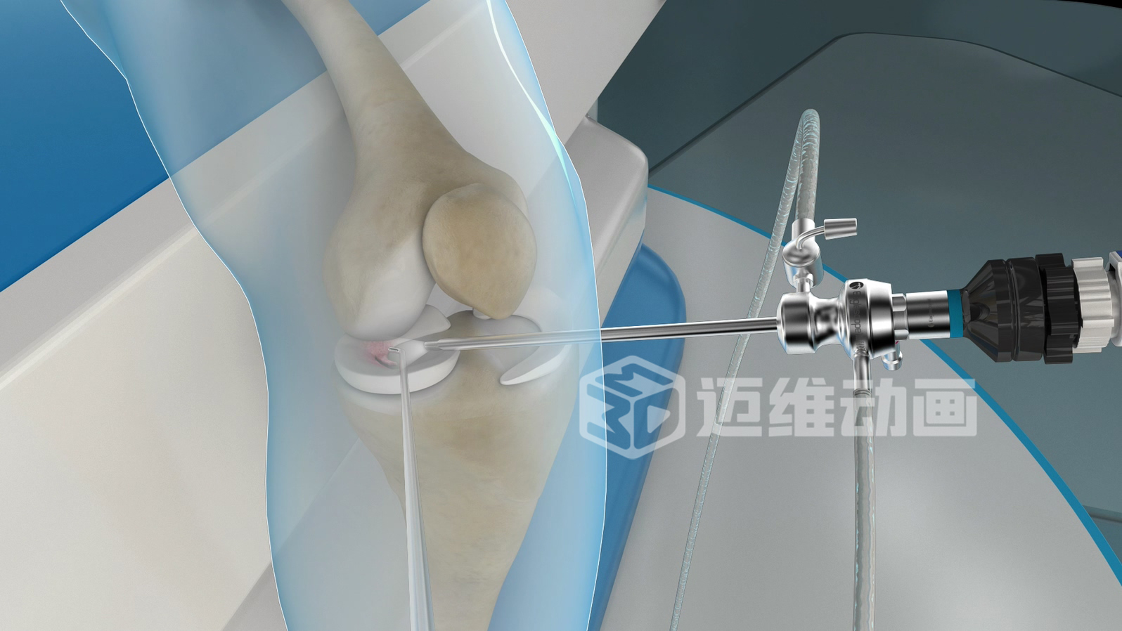 從 “看不懂” 到 “秒懂”，醫(yī)學(xué)醫(yī)療三維動(dòng)畫憑什么兼顧專業(yè)度與傳播力？(圖1)